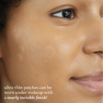 Patch Me Up Waterproof Pimple Patches - Image 3