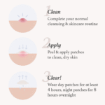 Patch Me Up Waterproof Pimple Patches - Image 4